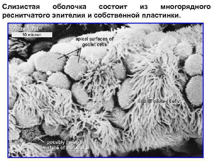 Слизистая оболочка состоит из многорядного реснитчатого эпителия и собственной пластинки. 