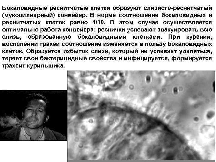 Бокаловидные реснитчатые клетки образуют слизисто-реснитчатый (мукоцилиарный) конвейер. В норме соотношение бокаловидных и реснитчатых клеток