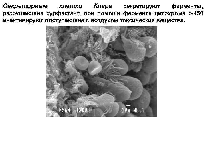 Секреторные клетки Клара секретируют ферменты, разрушающие сурфактант, при помощи фермента цитохрома р-450 инактивируют поступающие