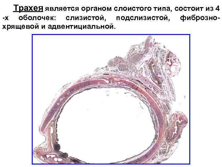 Трахея является органом слоистого типа, состоит из 4 -х оболочек: слизистой, подслизистой, хрящевой и