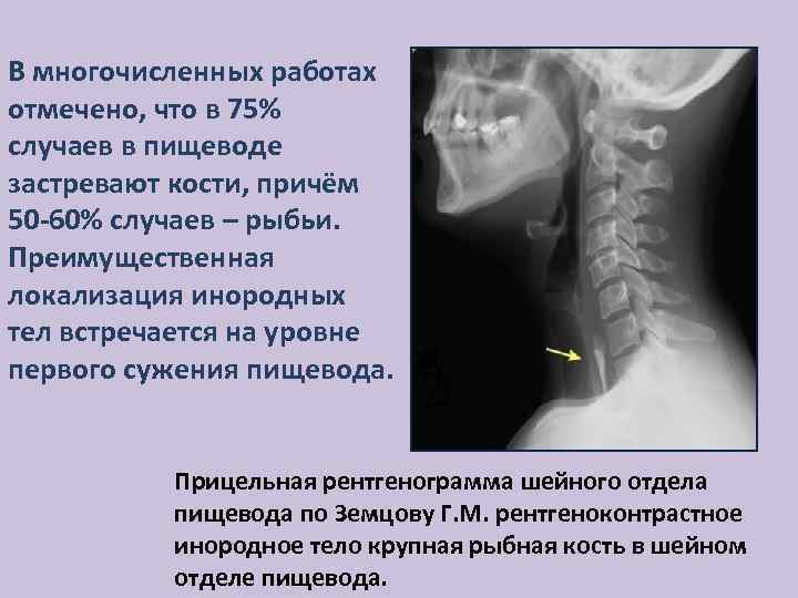 Травма шейного отдела позвоночника карта вызова