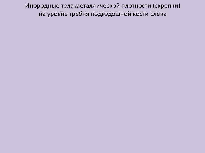 Инородные тела металлической плотности (скрепки) на уровне гребня подвздошной кости слева 