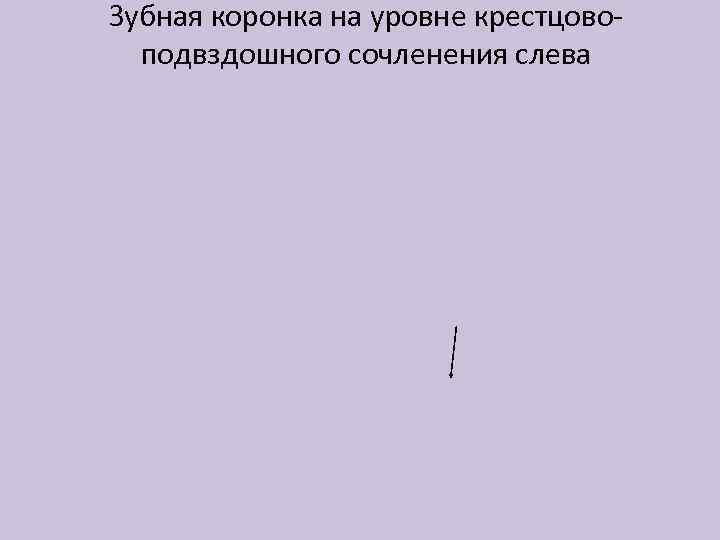 Зубная коронка на уровне крестцовоподвздошного сочленения слева 