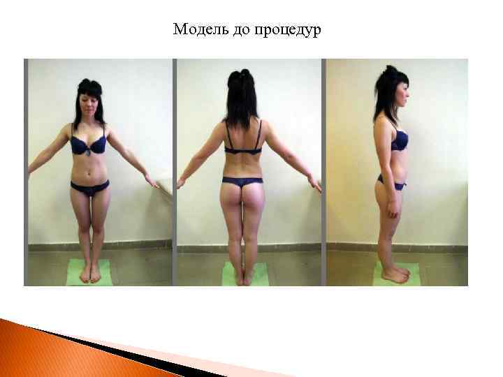 Модель до процедур 