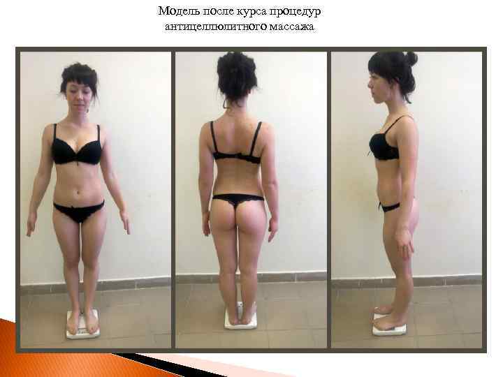 Модель после курса процедур антицеллюлитного массажа 