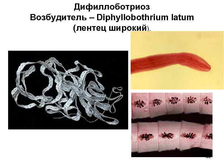Дифиллоботриоз Возбудитель – Diphyllobothrium latum (лентец широкий). 44 