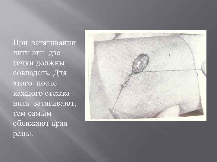 При затягивании нити эти две точки должны совпадать. Для этого после каждого стежка нить