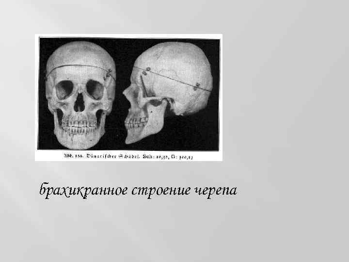 брахикранное строение черепа 