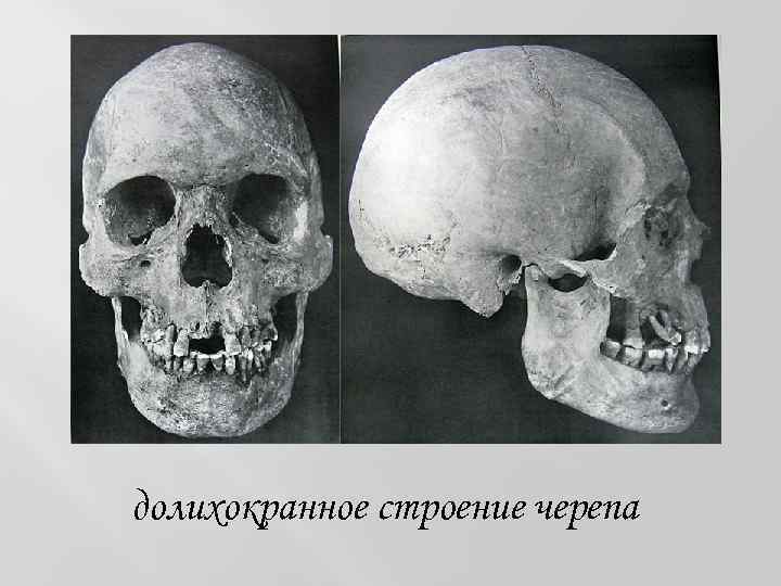 долихокранное строение черепа 