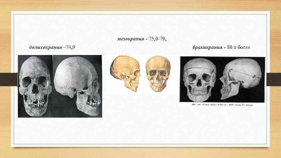 мезокрания - 75, 0 -79, долихокрания – 74, 9 брахикрания - 80 и более