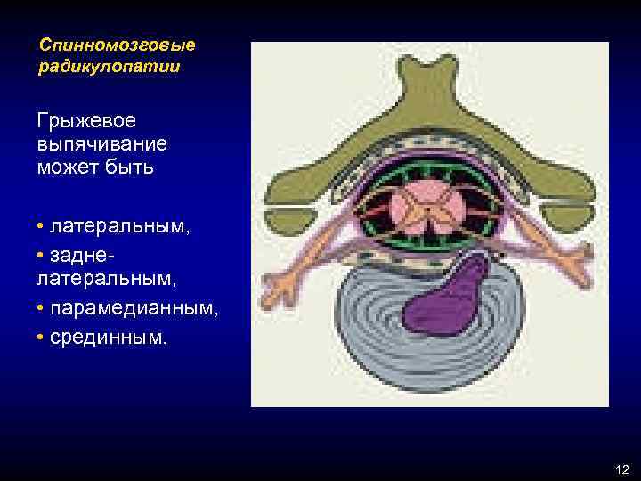 Заболевания периферической нервной системы неврология презентация