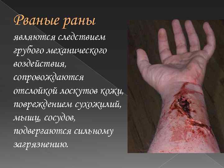 Рваные раны являются следствием грубого механического воздействия, сопровождаются отслойкой лоскутов кожи, повреждением сухожилий, мышц,