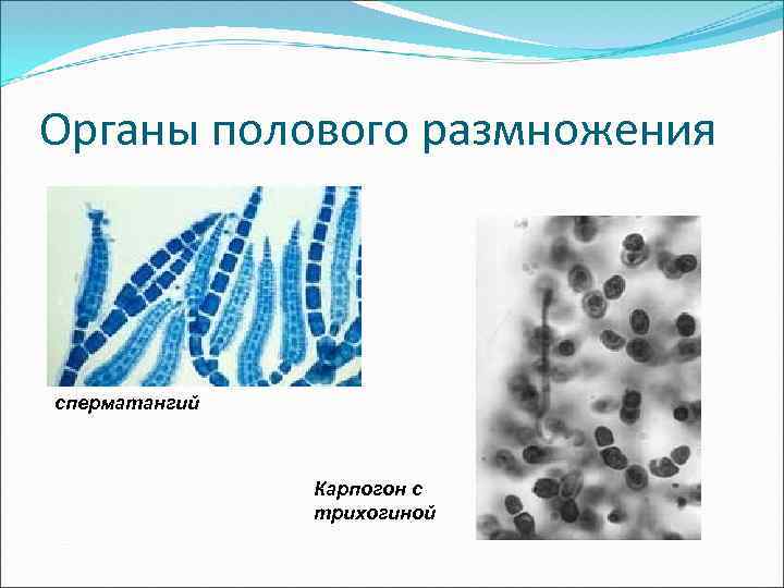 Органы полового размножения сперматангий Карпогон с трихогиной 