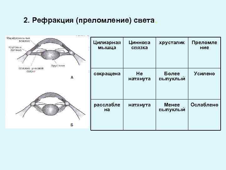 Рефракция связей. Хрусталик цинновы связки. Хрусталик менее выпуклый. Схема глаза цинновая свящка. Циннова связка и цилиарная мышца.