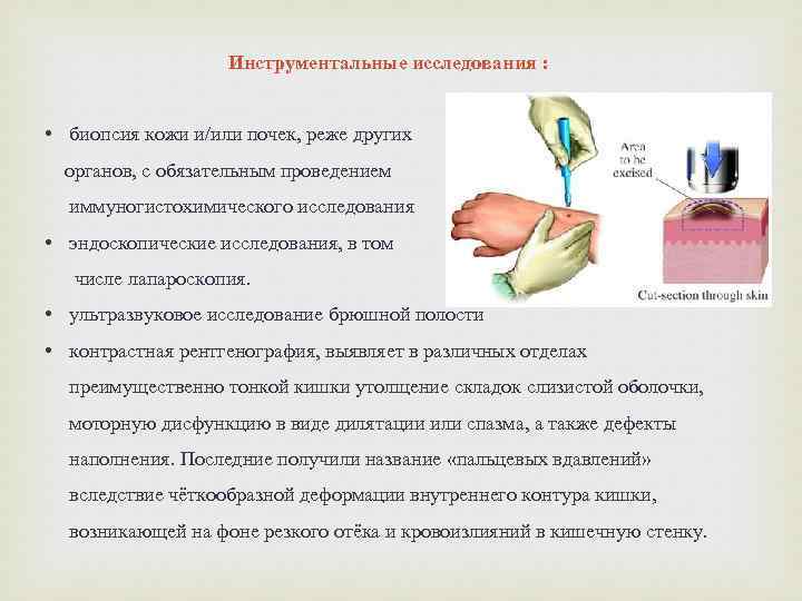 Биопсия кожи