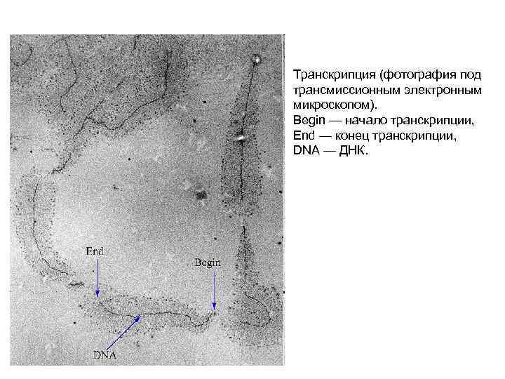 Транскрипция (фотография под трансмиссионным электронным микроскопом). Begin — начало транскрипции, End — конец транскрипции,
