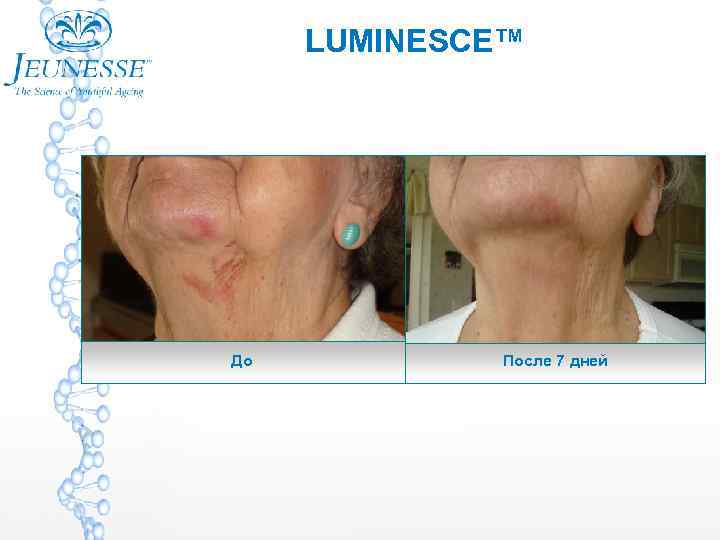 LUMINESCE™ До После 7 дней 