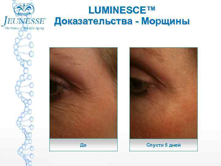 LUMINESCE™ Доказательства - Морщины До Спустя 5 дней 