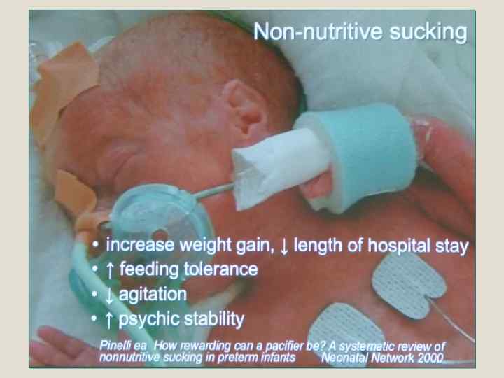 Болевой синдром у новорожденного последствия