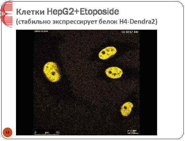 Клетки Hep. G 2+Etoposide (стабильно экспрессирует белок H 4 -Dendra 2) 18 