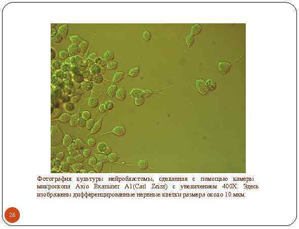 Фотография культуры нейробластомы, сделанная с помощью камеры микроскопа Axio Examiner A 1(Carl Zeiss) с