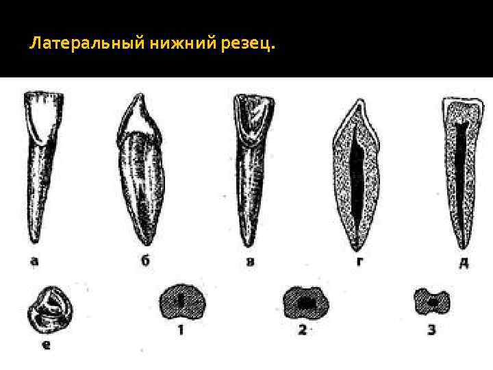 Центральных резцов. Резец первый премоляр анатомия. Краевые гребешки премоляра. Правый медиальный Нижний резец 3.41. Краевой гребень премоляр.