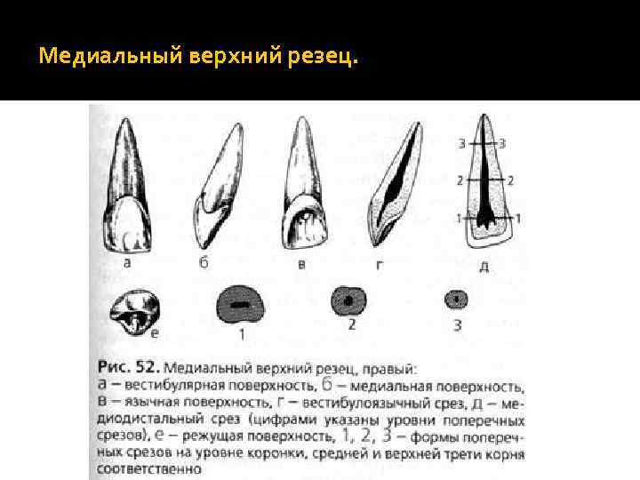 Верхних резцов