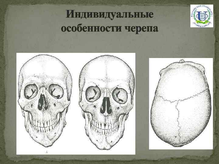 Индивидуальные особенности черепа 