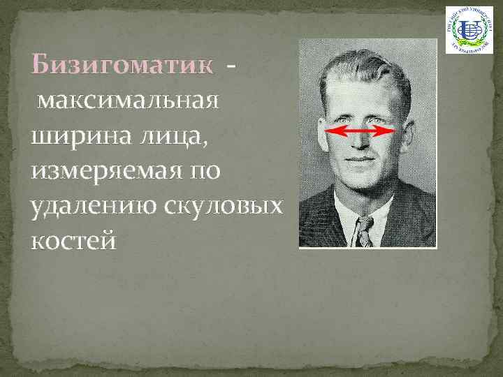 Бизигоматик максимальная ширина лица, измеряемая по удалению скуловых костей 