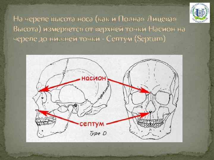 На черепе высота носа (как и Полная Лицевая Высота) измеряется от верхней точки Насион