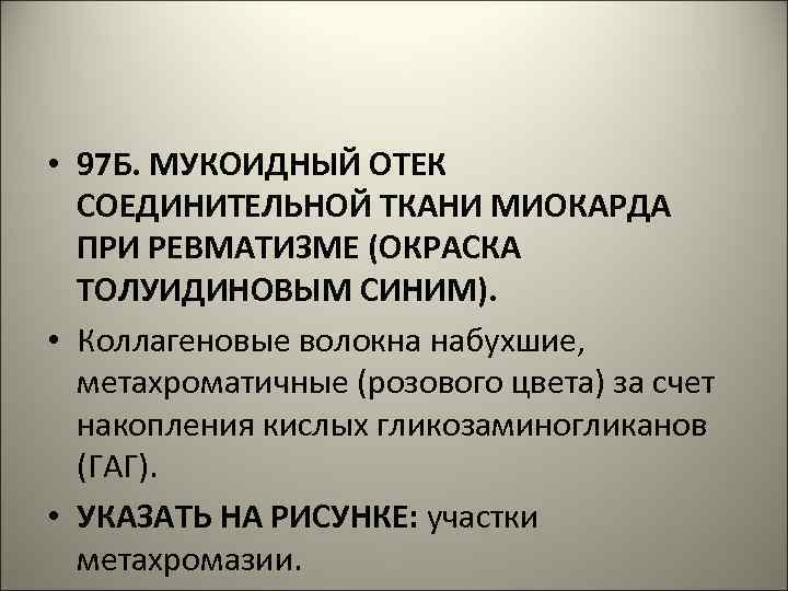  • 97 Б. МУКОИДНЫЙ ОТЕК СОЕДИНИТЕЛЬНОЙ ТКАНИ МИОКАРДА ПРИ РЕВМАТИЗМЕ (ОКРАСКА ТОЛУИДИНОВЫМ СИНИМ).