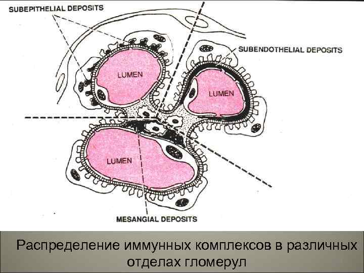 Распределение иммунных комплексов в различных 10 отделах гломерул 