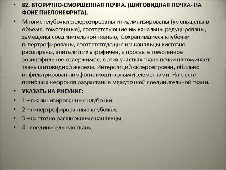  • 82. ВТОРИЧНО-СМОРЩЕННАЯ ПОЧКА. (ЩИТОВИДНАЯ ПОЧКА- НА ФОНЕ ПИЕЛОНЕФРИТА). • Многие клубочки склерозированы