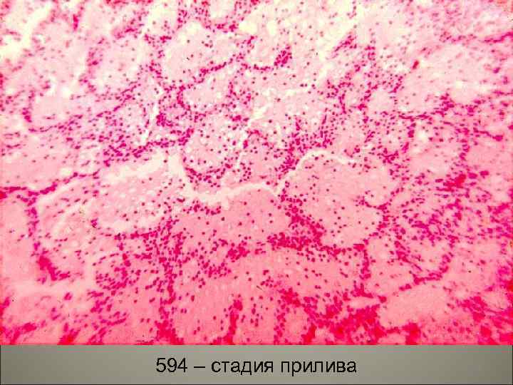 594 – стадия прилива 48 