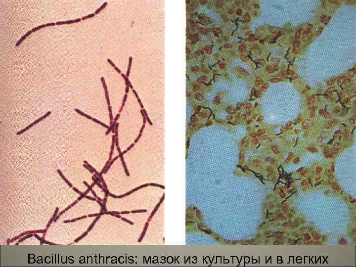 111 Bacillus anthracis: мазок из культуры и в легких 