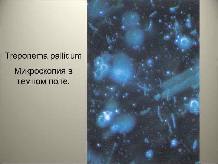 Treponema pallidum Микроскопия в темном поле. 5 