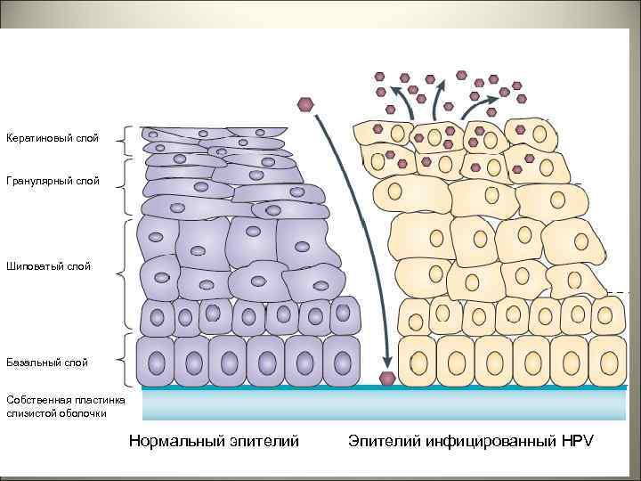 Кератиновый слой Гранулярный слой Шиповатый слой Базальный слой Собственная пластинка слизистой оболочки Нормальный эпителий