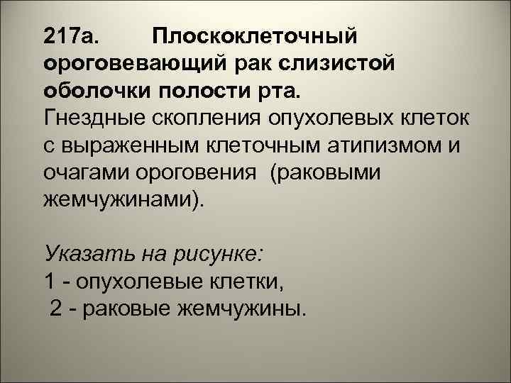 217 а. Плоскоклеточный ороговевающий рак слизистой оболочки полости рта. Гнездные скопления опухолевых клеток с