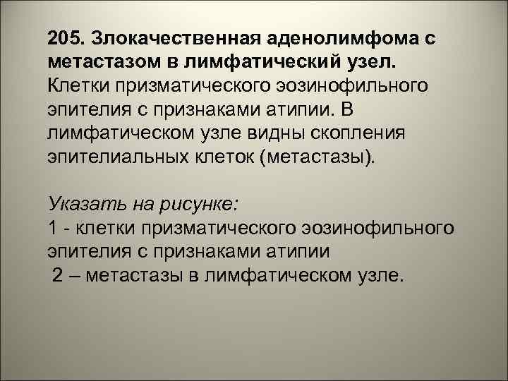 205. Злокачественная аденолимфома с метастазом в лимфатический узел. Клетки призматического эозинофильного эпителия с признаками