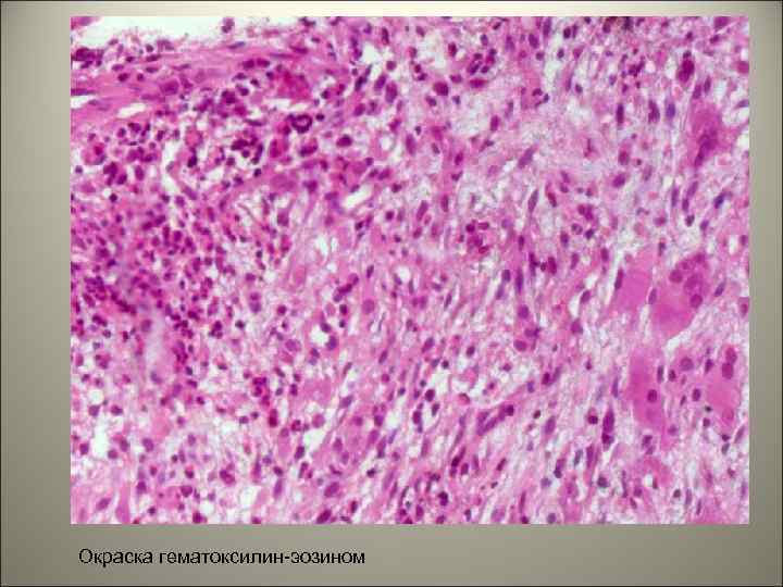 Окраска гематоксилин-эозином 