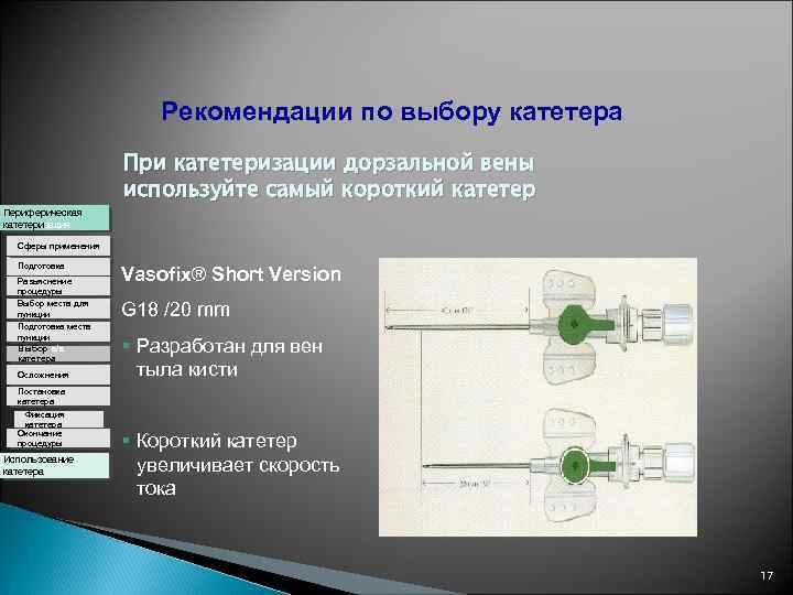 Рекомендации по выбору катетера Периферическая катетеризация При катетеризации дорзальной вены используйте самый короткий катетер