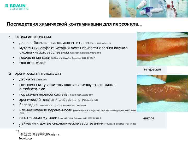 Последствия химической контаминации для персонала… острая интоксикация: 1. • • диарея, болезненные ощущения в