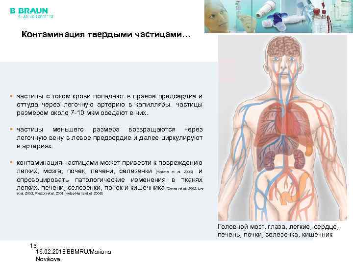 Контаминация твердыми частицами… § частицы с током крови попадают в правое предсердие и оттуда