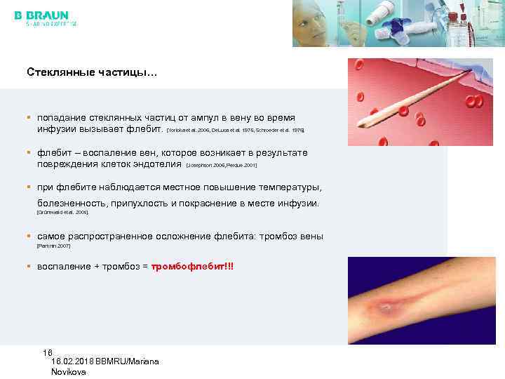 Стеклянные частицы… § попадание стеклянных частиц от ампул в вену во время инфузии вызывает