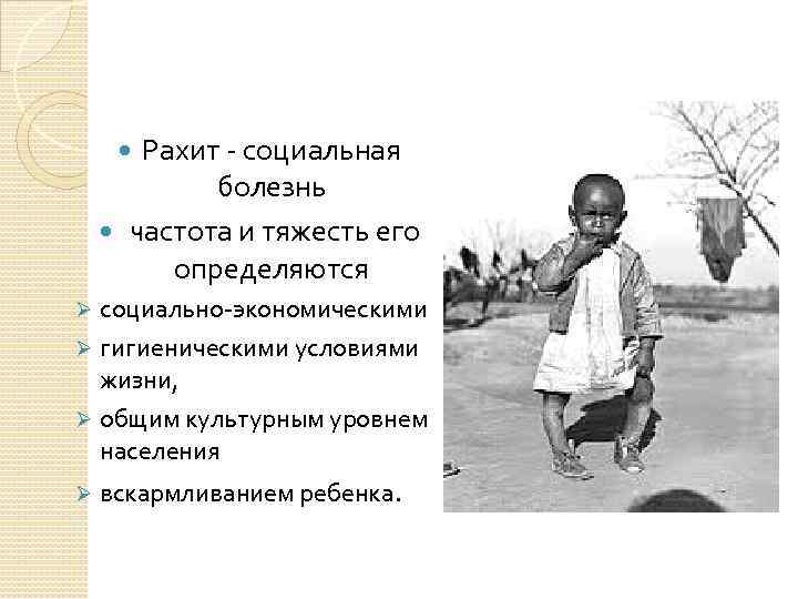 Рахит - социальная болезнь частота и тяжесть его определяются социально-экономическими Ø гигиеническими условиями жизни,