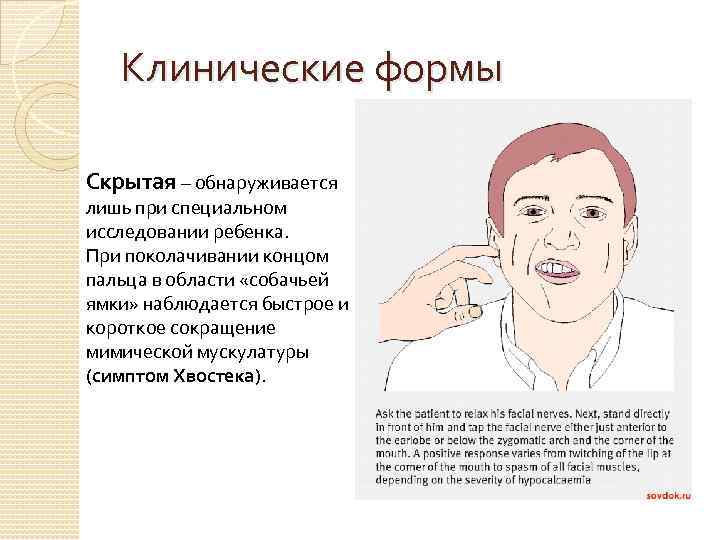 Клинические формы Скрытая – обнаруживается лишь при специальном исследовании ребенка. При поколачивании концом пальца