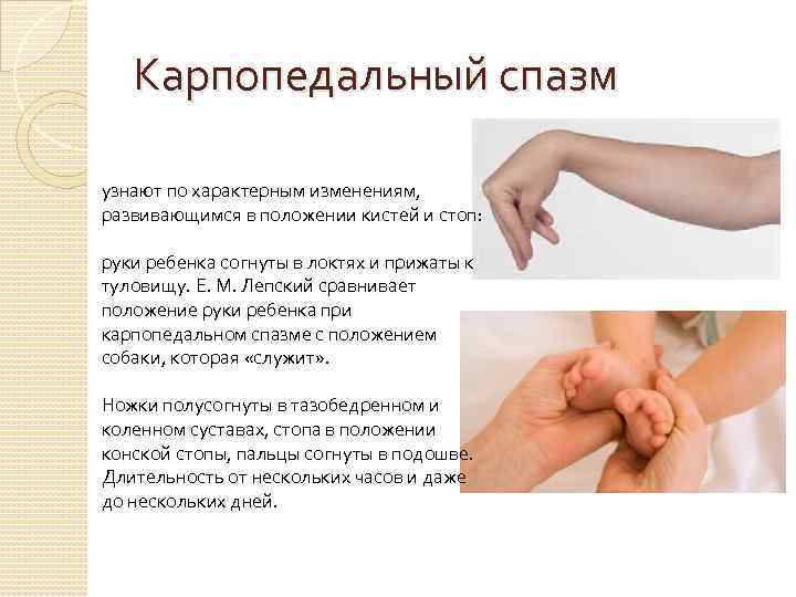 Карпопедальный спазм узнают по характерным изменениям, развивающимся в положении кистей и стоп: руки ребенка