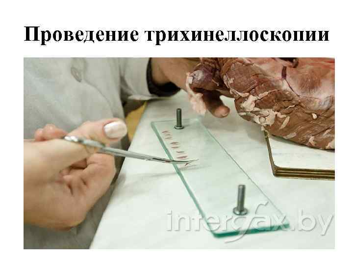 Проведение трихинеллоскопии 
