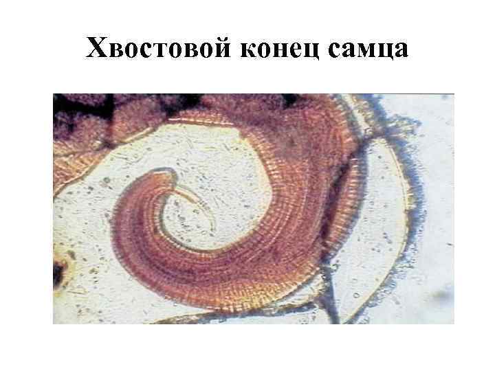 Хвостовой конец самца 