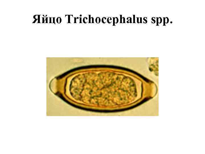 Яйцо Trichocephalus spp. 